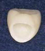 人工歯画像(奥歯)